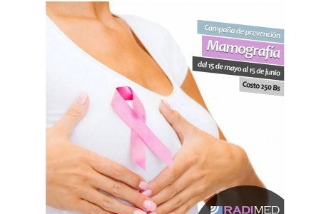 MAMOGRAFIA DIGITALIZADA
