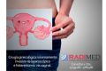 CIRUGIA GINECOLOGICA MINIMAMENTE INVASIVA