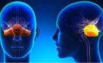 QUE CAUSA LA MALFORMACIÓN DE CHIARI