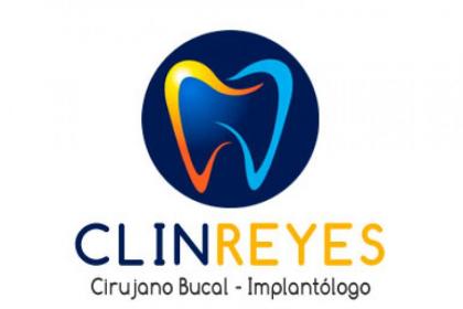 CLIN REYES
