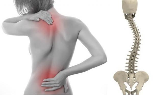 ESCOLIOSIS CONGÉNITA