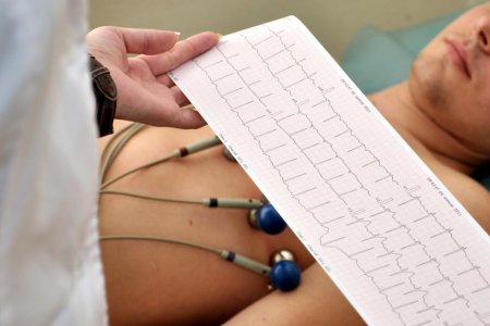 ELECTROCARDIOGRAMA