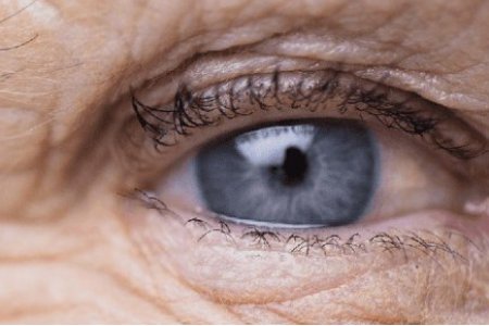 DEGENERACIÓN MACULAR