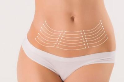 LIPOESCULTURA