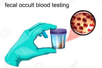 SANGRE OCULTA EN HECES 